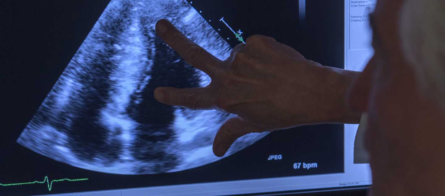 Outstretched hand on an ultrasound image