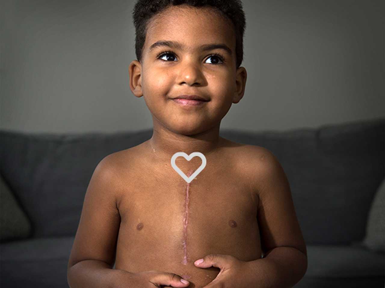 Young child with a scar on his chest
